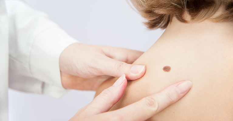 Dutch company receives €20 million for skin cancer diagnostic test