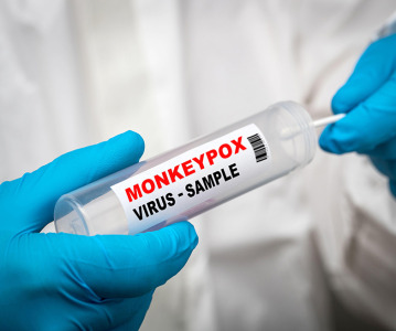 South Korea's Seegene develops PCR test to detect monkeypox virus