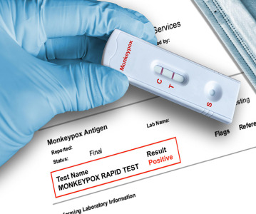 Monkeypox Update: Vaccine shortage, sewage surveillance and global testing