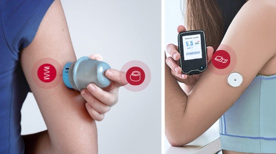 Springs for CGM (Continues Glucose Monitoring)