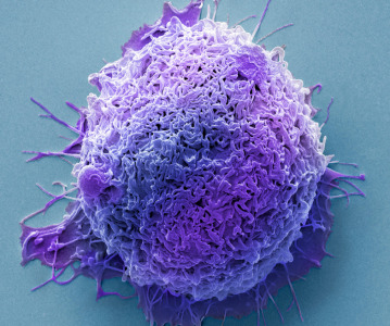 AI-powered therapy offers hope for rare familial polyposis