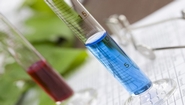 Amgen & UCB Announce Positive Phase 2 Results of AMG 785/CDP7851