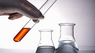 BioLineRx Signs License Deal for Pain Treatment BL-7050