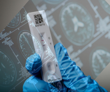 Detecting Alzheimer's disease with a simple lateral flow test