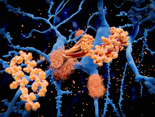 Eli Lilly’s Alzheimer’s drug receives approval from US FDA