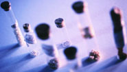 Epizyme Lands $650M GSK Deal