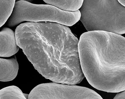 Essential malaria parasite genes revealed