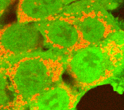 Gene-Silencing Study Finds New Targets for Parkinsons Disease