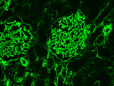 Heparan sulfate antibodies applications guide