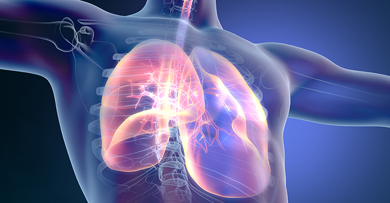 Hovione collaborates with Kiel University on high dose inhalation delivery