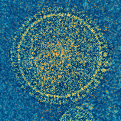 NIH Scientists Develop Candidate Vaccine Against Respiratory Syncytial Virus
