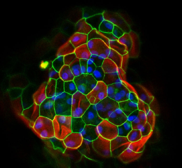 Organoid Biobank for Predicting Cancer Patient Response to Drugs