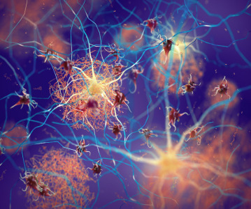 PharmaKure gains authorisation for next stage testing on Alzheimer's treatment