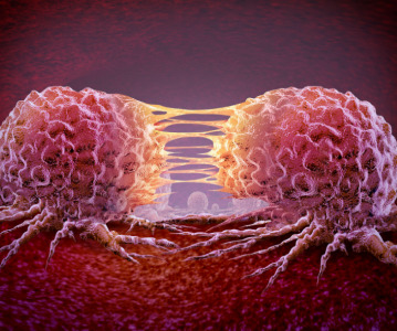 Roche acquires rights to Zion Pharma's HER2-positive breast cancer therapeutic