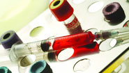 Targacept ADHD candidate shows disappointing results in Ph2 trial