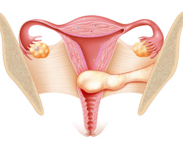 US FDA pauses clinical trial of BLU-222 amid safety concerns