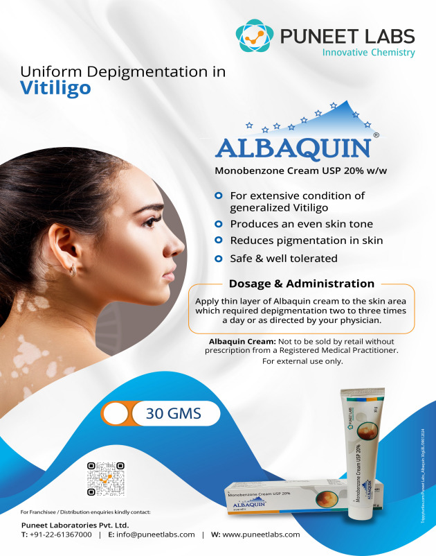 Albaquin Monobenzone Cream 20%