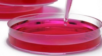 Analytics & Microbiology