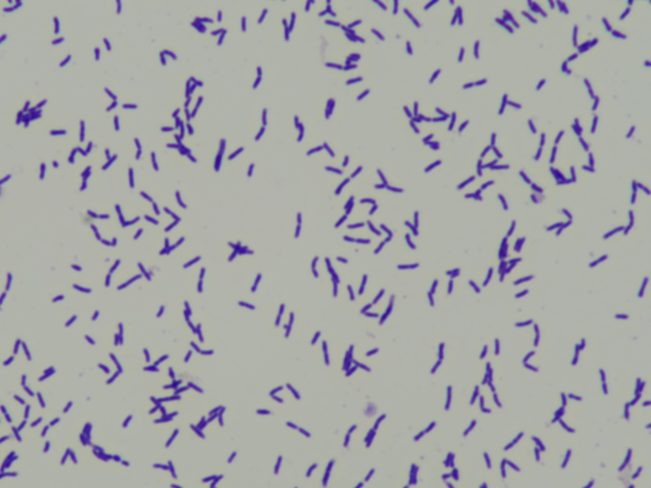 Bifidobacterium breve