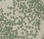Clopidogrel Bisulfate (Clopidogrel Hydrogen Sulfate) 3