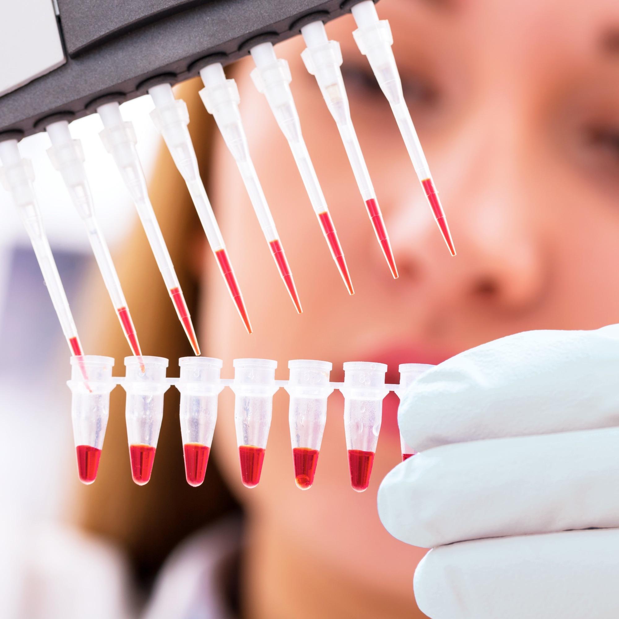 Diagnostics systems