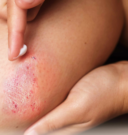 DuPont™ Liveo™ Topical Formulation Concepts