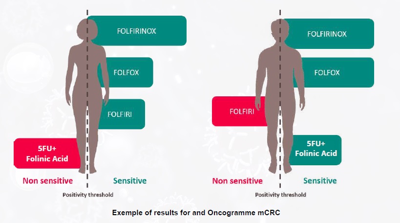 Ex Vivo Solid Tumor Model: The Oncogramme®, a new functional test in oncology 3