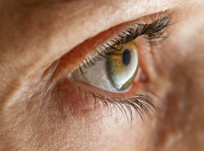 EyeCare