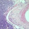 Harris hematoxylin 3