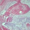 Harris hematoxylin 2