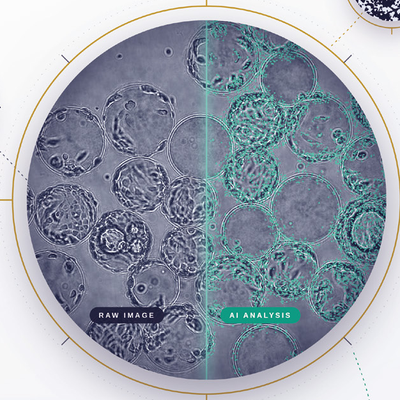 Image analysis software trained on your data