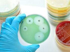 Microbial Limits Testing (MLT)