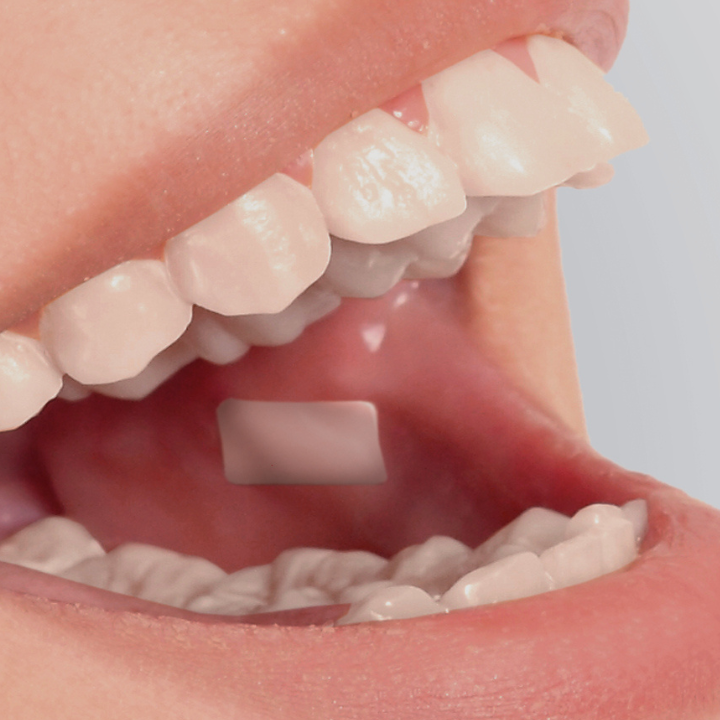 Mucoadhesive oral films