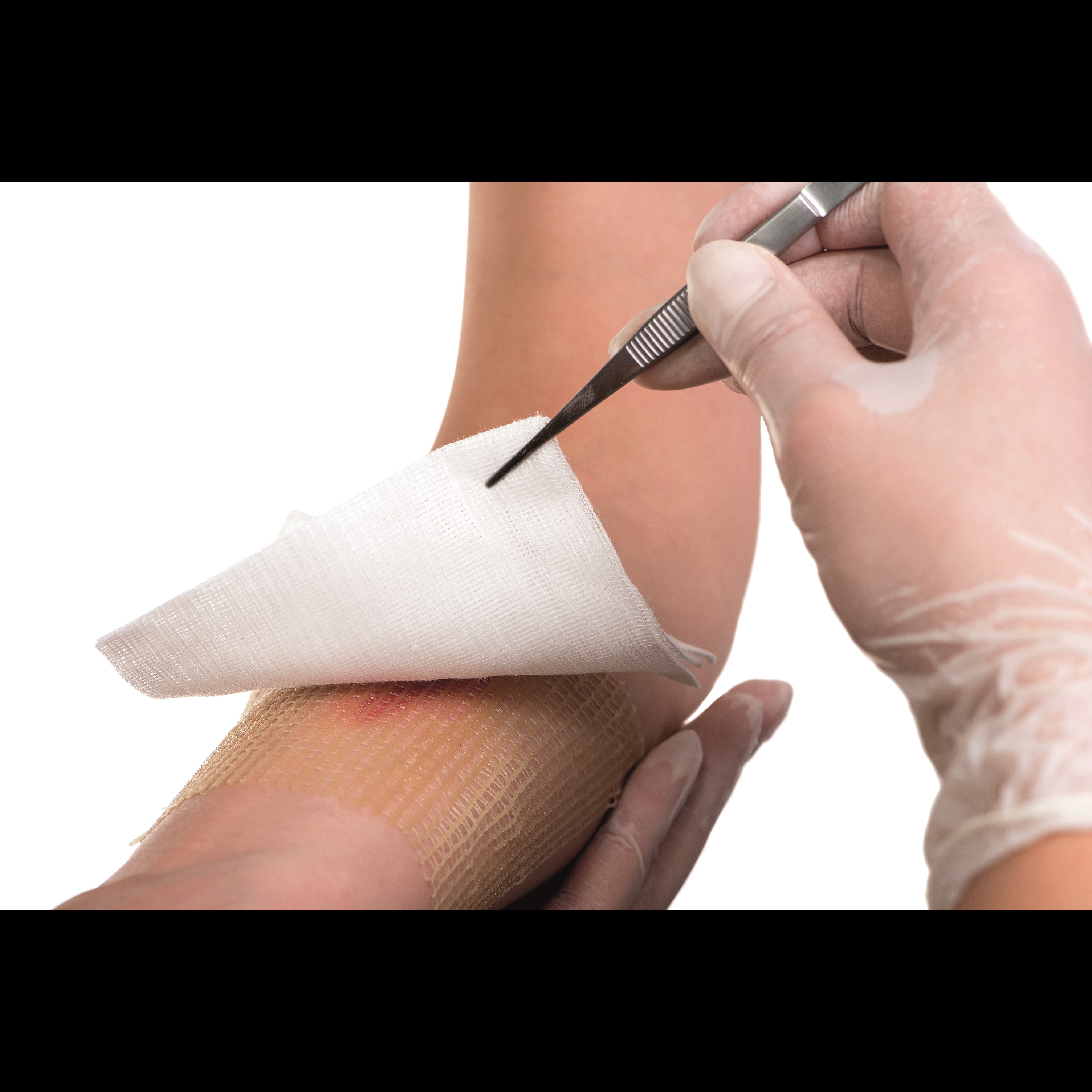 New (GAUZES  FOR INFECTED WOUNDS) 2