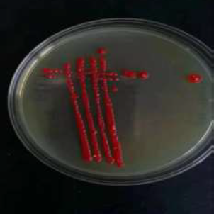 Phaffia Rhodozyma