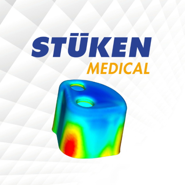 STÜKEN offers digital solutions in tool design and toolmaking