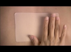 Transdermal Patch